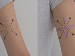 Tatuagem para diabéticos que muda de cor quando os níveis de glicose no sangue se alteram