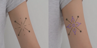Tatuagem para diabéticos que muda de cor quando os níveis de glicose no sangue se alteram Tatuagem para diabéticos que muda de cor quando os níveis de glicose no sangue se alteram