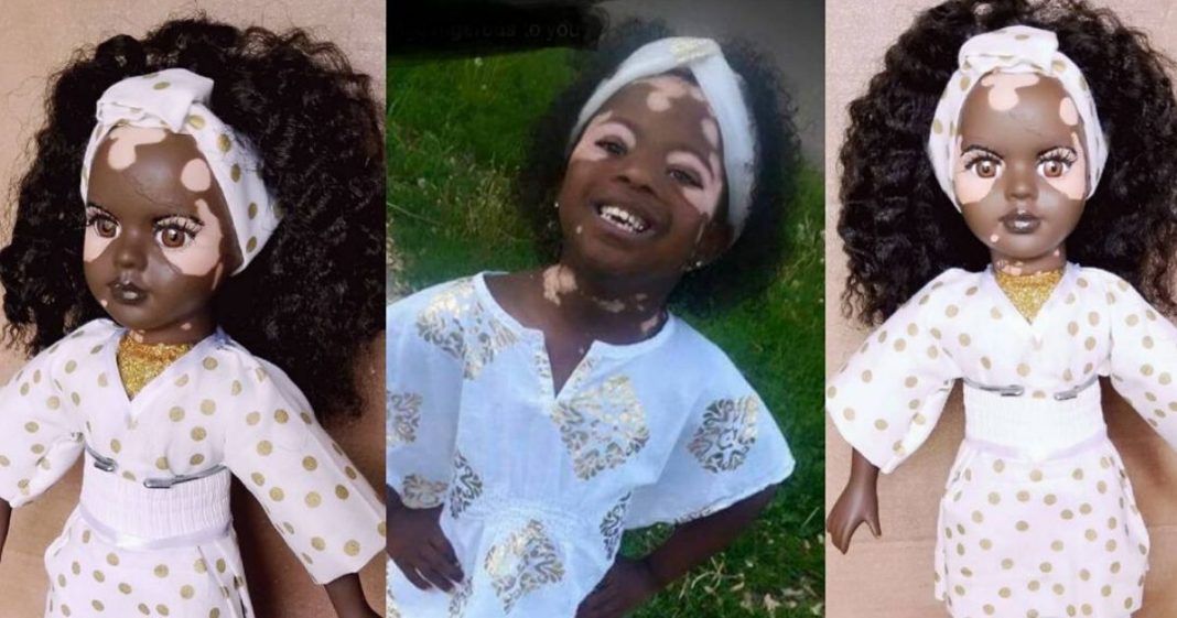 Bonecas com vitiligo fazem crianças se amarem do jeito que são