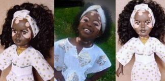 Bonecas com vitiligo fazem crianças se amarem do jeito que são Bonecas com vitiligo fazem crianças se amarem do jeito que são