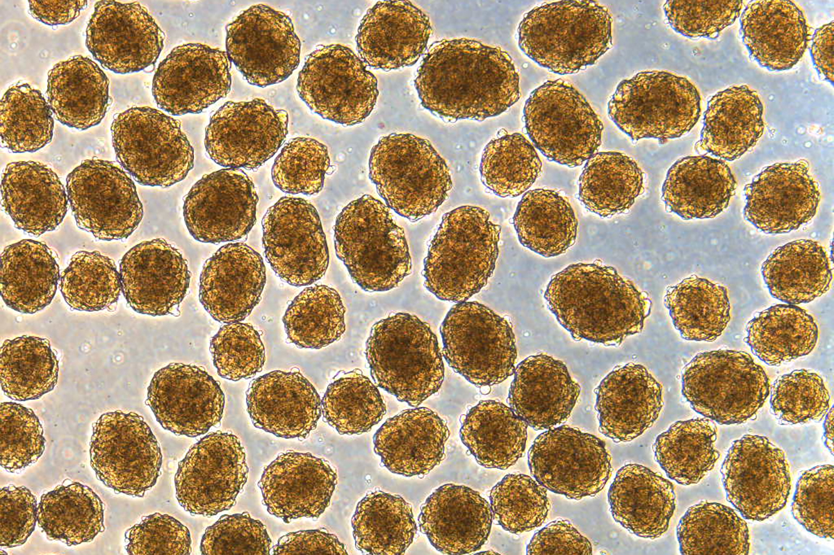 Pesquisadores conseguem curar Diabetes em ratos através de células-tronco humanas ideiasnutritivas.com - Pesquisadores conseguem curar Diabetes em ratos através de células-tronco humanas