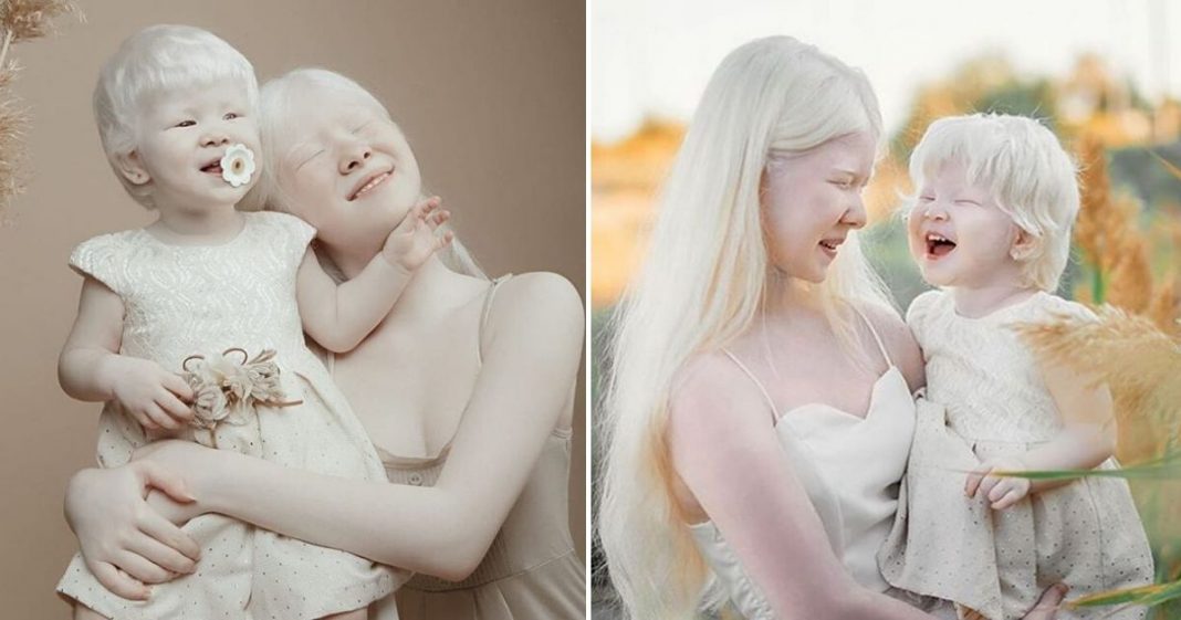Irmãs albinas surpreendem o mundo com sua beleza extraordinária