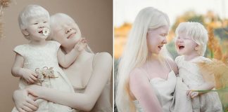 Irmãs albinas surpreendem o mundo com sua beleza extraordinária Irmãs albinas surpreendem o mundo com sua beleza extraordinária