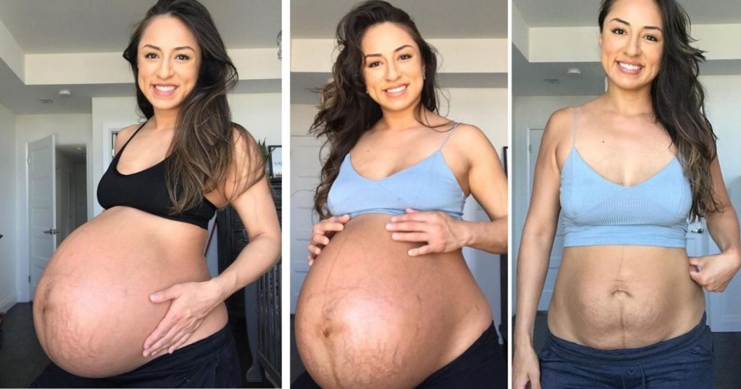 Mãe de gêmeos compara antes e depois do corpo de dar à luz
