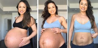 Mãe de gêmeos compara antes e depois do corpo de dar à luz Mãe de gêmeos compara antes e depois do corpo de dar à luz