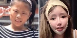 Jovem de 16 de anos faz mais de 100 cirurgias plásticas em apenas 3 anos Jovem de 16 de anos faz mais de 100 cirurgias plásticas em apenas 3 anos