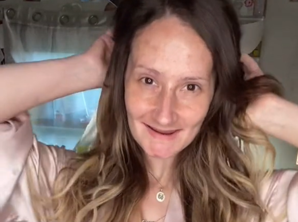 Influencer que perdeu os dentes mostra com orgulho sua transformação, apesar das críticas. ideiasnutritivas.com - Influencer que perdeu os dentes mostra com orgulho sua transformação, apesar das críticas.