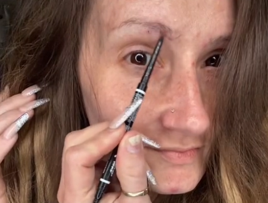 Influencer que perdeu os dentes mostra com orgulho sua transformação, apesar das críticas. ideiasnutritivas.com - Influencer que perdeu os dentes mostra com orgulho sua transformação, apesar das críticas.