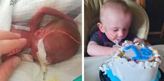 Bebê mais prematuro do mundo comemora seu 1º aniversário depois de 0% chance de sobreviver Bebê mais prematuro do mundo comemora seu 1º aniversário depois de 0% chance de sobreviver