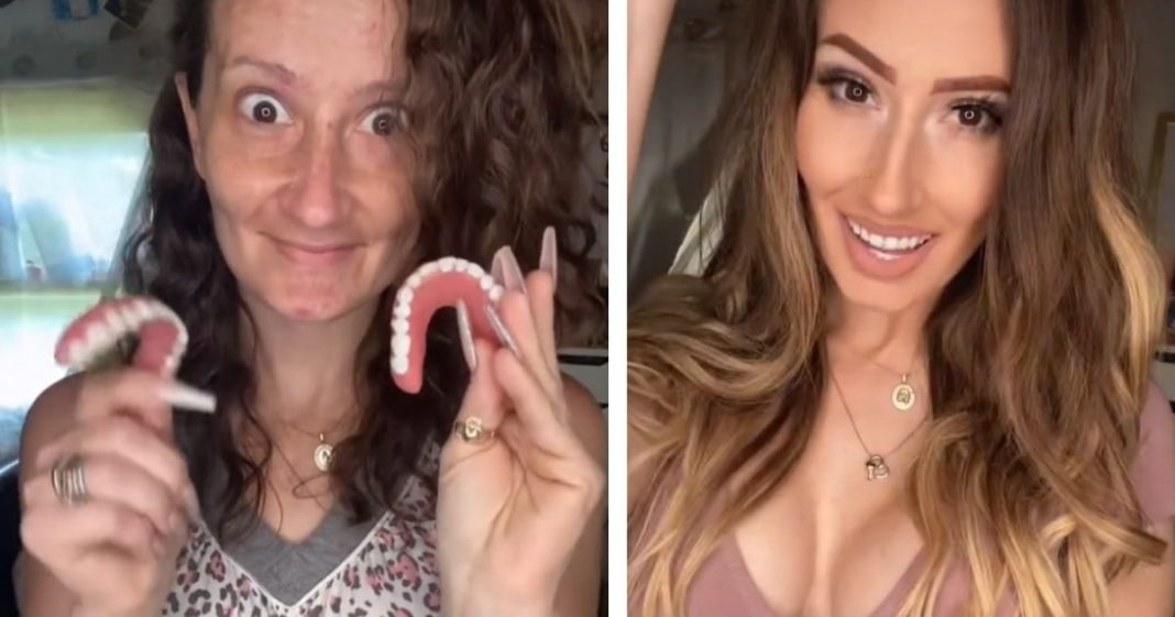 Influencer que perdeu os dentes mostra com orgulho sua transformação, apesar das críticas.