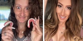 Influencer que perdeu os dentes mostra com orgulho sua transformação, apesar das críticas. Influencer que perdeu os dentes mostra com orgulho sua transformação, apesar das críticas.