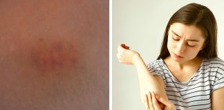 10 sinais que seu corpo lhe envia quando algo pode estar errado 10 sinais que seu corpo lhe envia quando algo pode estar errado