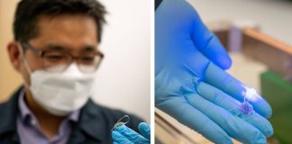 Cientistas criam dispositivo que ajuda as pessoas a perder peso sem cirurgia Cientistas criam dispositivo que ajuda as pessoas a perder peso sem cirurgia