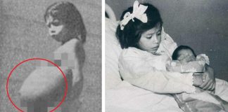 Lina Medina, uma menina de apenas 5 anos, é a mãe mais jovem do mundo Lina Medina, uma menina de apenas 5 anos, é a mãe mais jovem do mundo