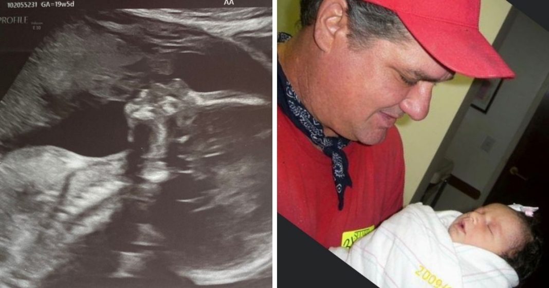 Grávida vê pai falecido beijando seu bebê no ultrassom e imagem viraliza