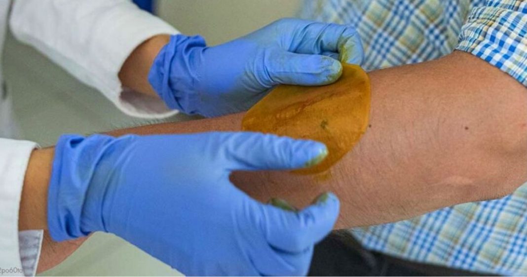 Cientistas criam adesivo que regenera feridas e pode evitar amputações em diabéticos