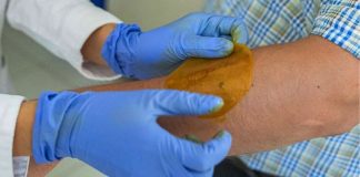 Cientistas criam adesivo que regenera feridas e pode evitar amputações em diabéticos Cientistas criam adesivo que regenera feridas e pode evitar amputações em diabéticos