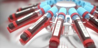 Um exame de sangue consegue detectar o câncer 10 anos antes que ele apareça: vai salvar vidas Um exame de sangue consegue detectar o câncer 10 anos antes que ele apareça: vai salvar vidas