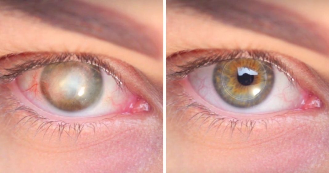 Cientistas criam córnea sintética que faz cegos recuperarem a visão