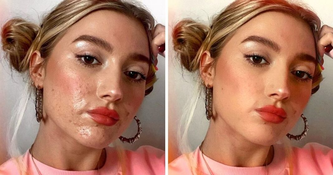 Mulheres fazem desafio #FilterDrop no Instagram compartilhando rostos sem filtros
