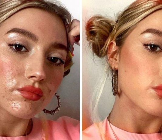 Mulheres fazem desafio #FilterDrop no Instagram compartilhando rostos sem filtros