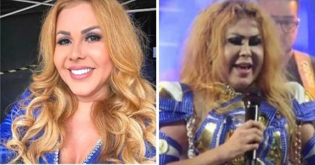 Cantora Joelma preocupa fãs ao aparecer com rosto muito inchado