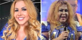 Cantora Joelma preocupa fãs ao aparecer com rosto muito inchado Cantora Joelma preocupa fãs ao aparecer com rosto muito inchado