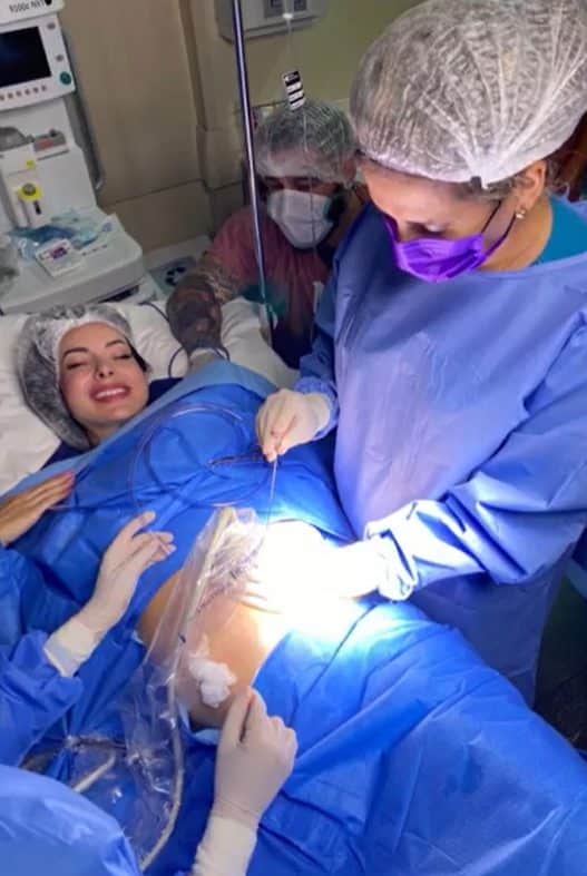 em cirurgia inedita no brasil medica queima tumor de bebe ainda no utero da mae 2 - Em cirurgia inédita no Brasil, médica 'queima' tumor de bebê ainda no útero da mãe