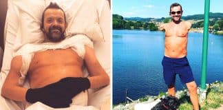 Homem com braços amputados há 24 anos faz transplante dos membros e abraça filha pela 1ª vez Homem com braços amputados há 24 anos faz transplante dos membros e abraça filha pela 1ª vez