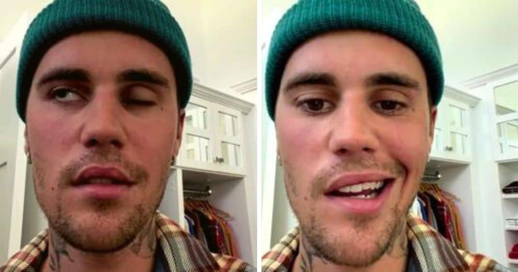 Justin Bieber foi atingido por paralisia facial causado por síndrome rara e cancela shows