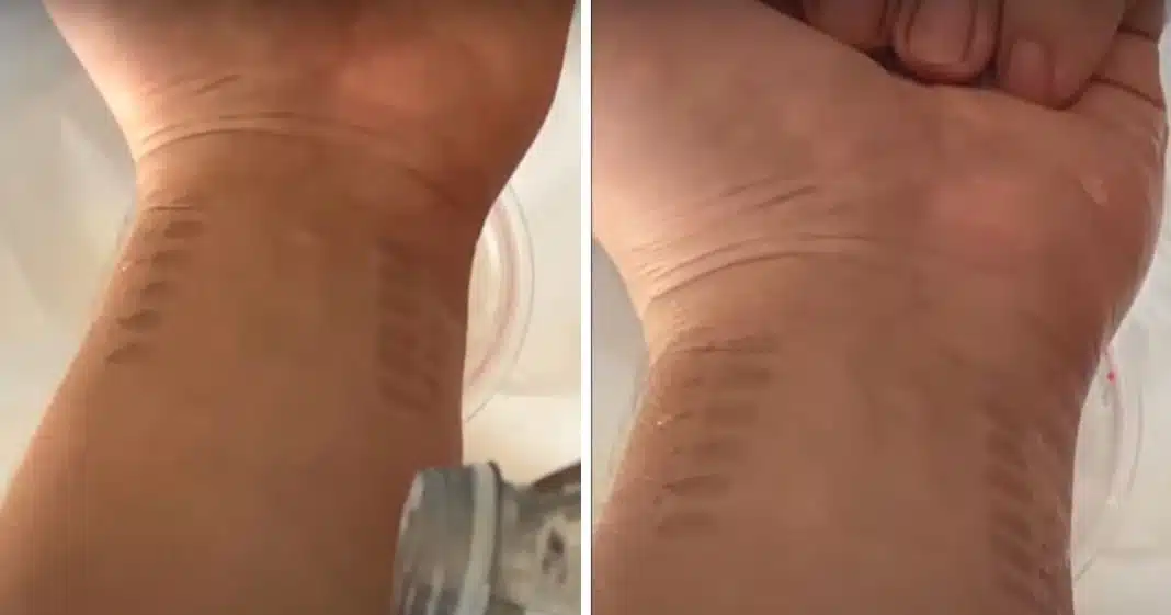 Pesquisadores criam tatuagem de grafeno que monitora pressão arterial