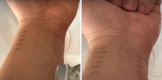 Pesquisadores criam tatuagem de grafeno que monitora pressão arterial Pesquisadores criam tatuagem de grafeno que monitora pressão arterial