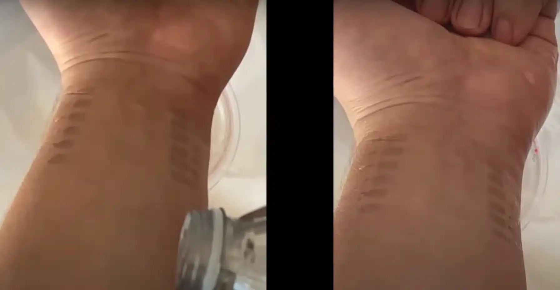 Pesquisadores criam tatuagem de grafeno que monitora pressão arterial ideiasnutritivas.com - Pesquisadores criam tatuagem de grafeno que monitora pressão arterial