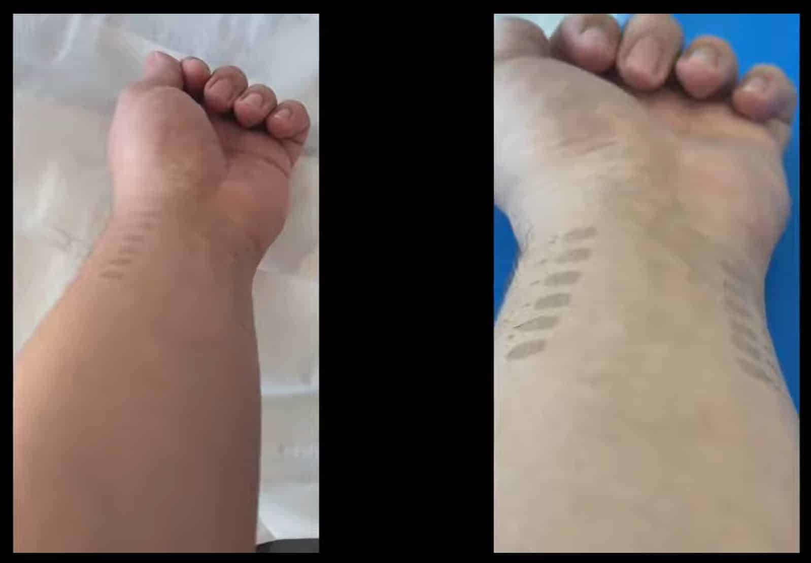 ideiasnutritivas.com - Pesquisadores criam tatuagem de grafeno que monitora pressão arterial