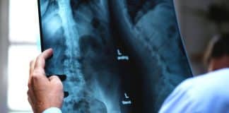 Deficiência de vitamina D? A ciência mostra o que acontece com o seu corpo